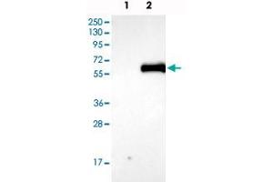 Western blot analysis of Lane 1: Negative control (vector only transfected HEK293T lysate), Lane 2: Over-expression Lysate (Co-expressed with a C-terminal myc-DDK tag (~3. (AGT anticorps)