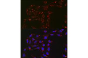 Immunofluorescence analysis of U2OS cells using  Rabbit mAb (ABIN7265367) at dilution of 1:100 (40x lens). (ACAA2 anticorps)