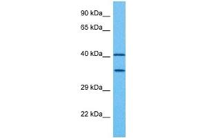 Host:  Rabbit  Target Name:  PAX2  Sample Tissue:  Human Ovary Tumor  Antibody Dilution:  1ug/ml