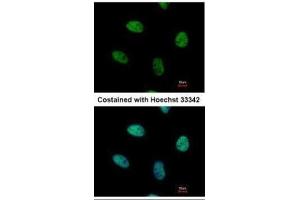 ICC/IF Image Immunofluorescence analysis of paraformaldehyde-fixed HeLa, using NUR77, antibody at 1:500 dilution. (NR4A1 anticorps  (C-Term))