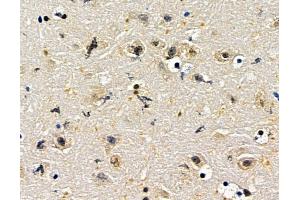 ABIN7096729 and ABIN7100794 at 1/100 staining mouse brain tissue by IHC-P. (ZNF382 anticorps)