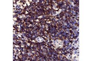 Immunohistochemistry of paraffin embedded human tonsil using CD3 (ABIN7073386) at dilution of 1: 1000 (400x lens) (CD3 anticorps)