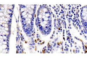 Detection of IL22R in Human Colon Tissue using Polyclonal Antibody to Interleukin 22 Receptor (IL22R) (IL22 Receptor alpha 1 anticorps  (AA 267-565))