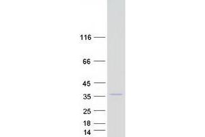 Validation with Western Blot