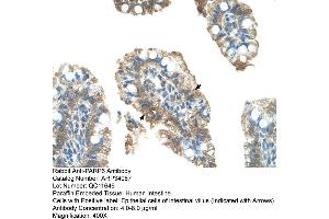 Human Intestine (PARP6 anticorps  (C-Term))