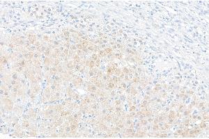 Immunohistochemistry (IHC) image for anti-Nicotinamide phosphoribosyltransferase (NAMPT) (AA 400-450) antibody (ABIN7454619) (NAMPT anticorps  (AA 400-450))