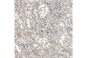 IHC analysis of SNRNP40 using anti-SNRNP40 antibody (ABIN7601719). (SNRNP40 anticorps  (AA 43-357))