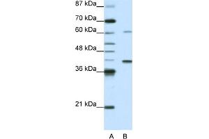 WB Suggested Anti-MGC46336 Antibody Titration:  0. (ZNF843 anticorps  (N-Term))