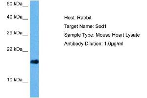 Host: Mouse Target Name: SOD1 Sample Tissue: Mouse Heart Antibody Dilution: 1ug/ml