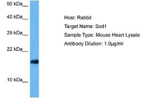 Host: Mouse Target Name: SOD1 Sample Tissue: Mouse Heart Antibody Dilution: 1ug/ml (SOD1 anticorps  (C-Term))