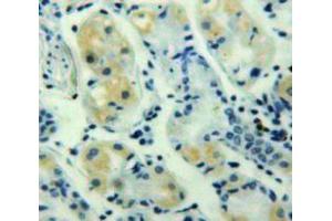 Used in DAB staining on fromalin fixed paraffin-embedded Stomach tissue (GRO gamma anticorps  (AA 35-107))