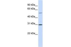 Image no. 1 for anti-NIMA related kinase 3 (NEK3) (AA 108-157) antibody (ABIN6741054)