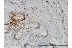 Immunoperoxidase of monoclonal antibody to PTK9 on formalin-fixed paraffin-embedded human ovary.