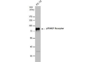 WB Image p75 NGF Receptor antibody detects p75 NGF Receptor protein by western blot analysis. (NGFR anticorps)