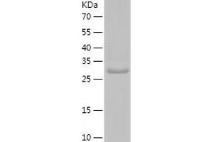 Western Blotting (WB) image for Plasminogen (PLG) (AA 98-356) protein (His-IF2DI Tag) (ABIN7124464)