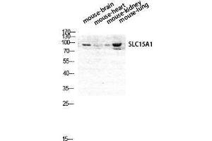 Western Blotting (WB) image for anti-Solute Carrier Family 15 (Oligopeptide Transporter), Member 1 (SLC15A1) (Internal Region) antibody (ABIN3176831) (SLC15A1 anticorps  (Internal Region))