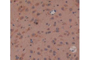 IHC-P analysis of brain tissue, with DAB staining. (Oligophrenin 1 anticorps  (AA 634-802))