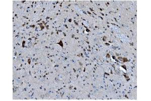IHC analysis of MAPK1 using anti-MAPK1 antibody (ABIN7600772).