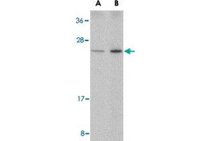 Western blot analysis of DDIT4 in human kidney tissue lysate with DDIT4 polyclonal antibody  at (A) 0. (DDIT4 anticorps  (Internal Region))