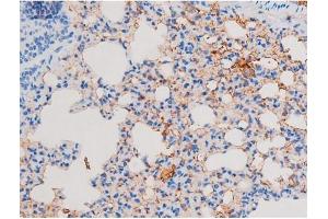 ABIN6267486 at 1/200 staining Mouse lung tissue sections by IHC-P.
