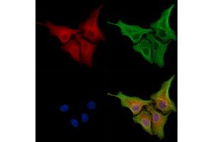 ABIN6261584 and ABIN6278325 staining Hela cells by IF/ICC. (ERAP1 anticorps  (Internal Region))