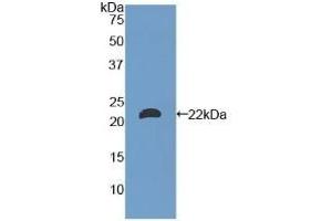 Detection of Recombinant LAMa1, Mouse using Polyclonal Antibody to Laminin Alpha 1 (LAMA1) (Laminin alpha 1 anticorps  (AA 2640-2773))