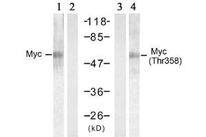 Western blot analysis of extracts from HT-29 cells treated with UV (20min), using Myc (Ab-358) antibody (E021035, Lane 1 and 2) and Myc (phospho-Thr358) antibody (E011035, Lane 3 and 4). (c-MYC anticorps  (pThr358))
