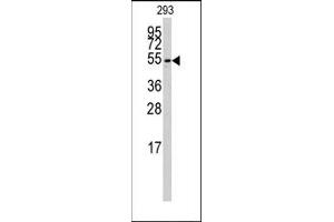 Image no. 1 for anti-Cytochrome P450, Family 26, Subfamily B, Polypeptide 1 (CYP26B1) (C-Term) antibody (ABIN360415) (CYP26B1 anticorps  (C-Term))