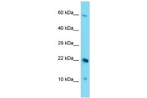 Host: Rabbit Target Name: C17orf105 Sample Type: HepG2 Whole Cell lysates Antibody Dilution: 1. (C17ORF105 anticorps  (Middle Region))
