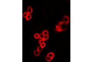 Immunofluorescent analysis of MALT1 staining in U2OS cells.