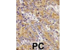 Immunohistochemistry (IHC) image for anti-Myosin ID (MYO1D) antibody (ABIN3002631) (Myosin ID anticorps)
