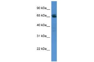 WB Suggested Anti-SMARCD3 Antibody Titration:  0. (SMARCD3 anticorps  (N-Term))