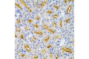 Immunohistochemistry of paraffin-embedded rat kidney using MyD88 Antibody (ABIN6128257, ABIN6144228, ABIN6144229 and ABIN6213986) at dilution of 1:100 (40x lens). (MYD88 anticorps  (AA 60-309))