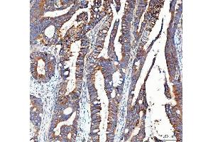 IHC analysis of Integrin alpha 3/ITGA3 using anti-Integrin alpha 3/ITGA3 antibody (ABIN7602696).