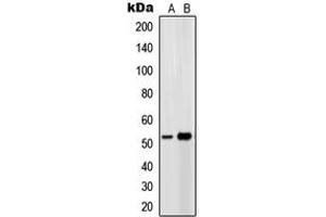 Western blot analysis of EP4 expression in Ramos (A), HeLa (B) whole cell lysates. (PTGER4 anticorps  (Center))