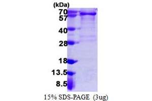 SDS-PAGE (SDS) image for Platelet Derived Growth Factor Receptor alpha (PDGFRA) (AA 24-524) protein (His tag) (ABIN6386789)