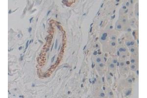 Detection of ACTg2 in Human Liver Tissue using Polyclonal Antibody to Actin Gamma 2, Smooth Muscle (ACTg2)