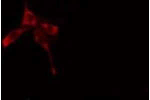 ABIN6269408 staining A549 cells by IF/ICC. (CaMK2 alpha/delta anticorps)