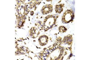 Immunohistochemistry of paraffin-embedded Human mammary gland using RPL13 antibody at dilution of 1:100 (x400 lens). (RPL13 anticorps)