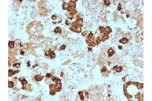 Formalin-fixed, paraffin-embedded human pituitary gland stained with ACTH Mouse Monoclonal Antibody (57).