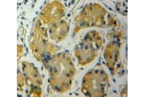 Used in DAB staining on fromalin fixed paraffin-embedded Stomach tissue (ADAMTS12 anticorps  (AA 823-997))