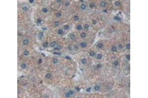 IHC-P analysis of Human Tissue, with DAB staining. (TNC anticorps  (AA 49-181))