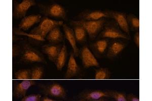 Immunofluorescence analysis of U-2 OS cells using PPP2R5D Polyclonal Antibody at dilution of 1:100.