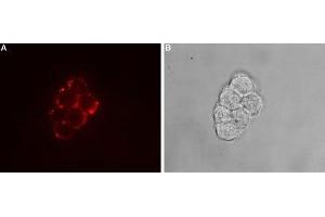 Expression of TRPC7 in rat PC12 cells - Cell surface detection of TRPC7 in intact living rat pheochromocytoma (PC12) cells using. (TRPC7 anticorps  (2nd Extracellular Loop))