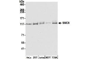 Western Blotting (WB) image for anti-SMC6 Structural Maintenance of Chromosomes 6-Like 1 (SMC6) (C-Term) antibody (ABIN7454597) (SMC6 anticorps  (C-Term))
