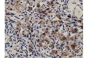 Image no. 8 for anti-Aldehyde Dehydrogenase 1 Family, Member L1 (ALDH1L1) antibody (ABIN1496585) (ALDH1L1 anticorps)