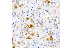 Immunohistochemistry of paraffin-embedded human brain using [KO Validated] LC3B Rabbit mAb (ABIN7268519) at dilution of 1:100 (40x lens).