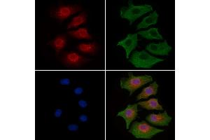 ABIN6262571 and ABIN6277224 staining HepG2 cells by IF/ICC.