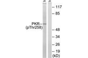 Western blot analysis of extracts from Jurkat cells treated with starved 24h, using PKR (Phospho-Thr258) Antibody. (EIF2AK2 anticorps  (pThr258))
