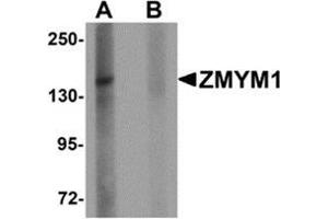 Western blot analysis of ZMYM1 in rat lung tissue lysate with ZMYM1 antibody at 1 μg/ml in (A) the absence and (B) the presence of blocking peptide. (ZMYM1 anticorps  (C-Term))
